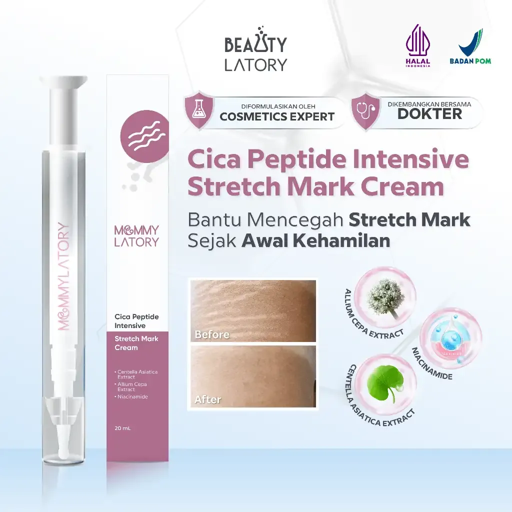 MOMMYALTORY Cica Peptide Intensive Stretch Mark Cream 25 ml